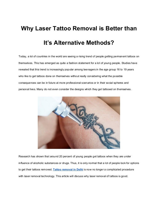 method of tattoo removal for teens Big tits miltf